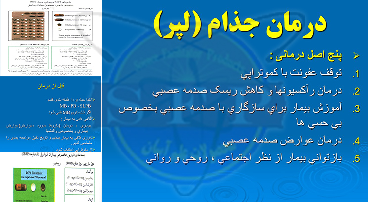 درمان جذام (لپر) – ارائه مطلب